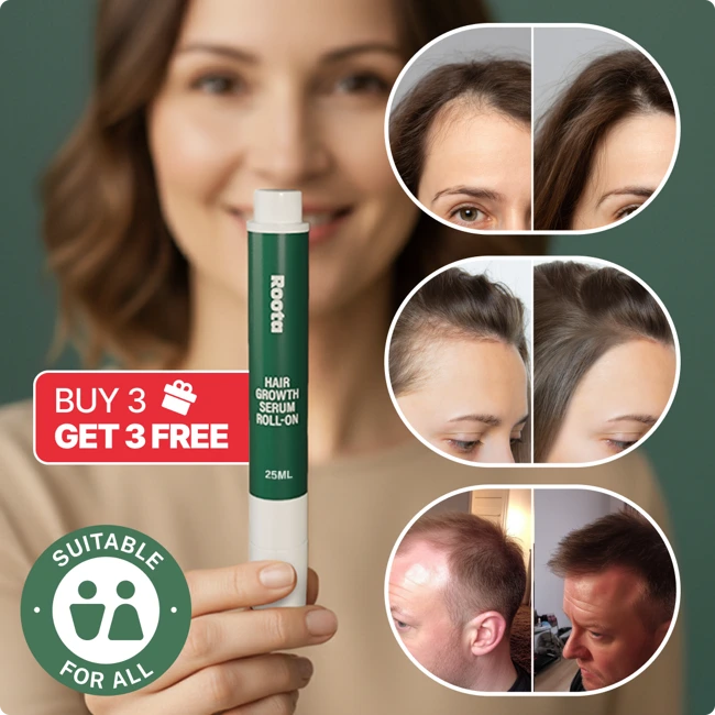 Roota Hair Growth Serum 1