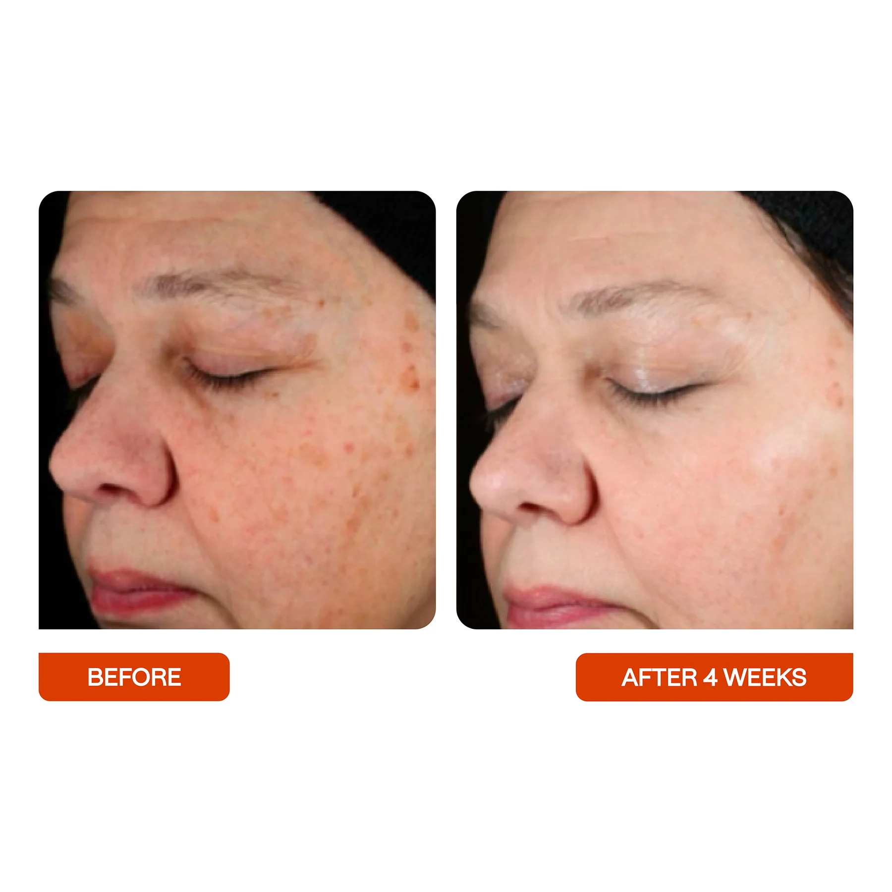 BeautyStat Universal C Skin Refiner 3