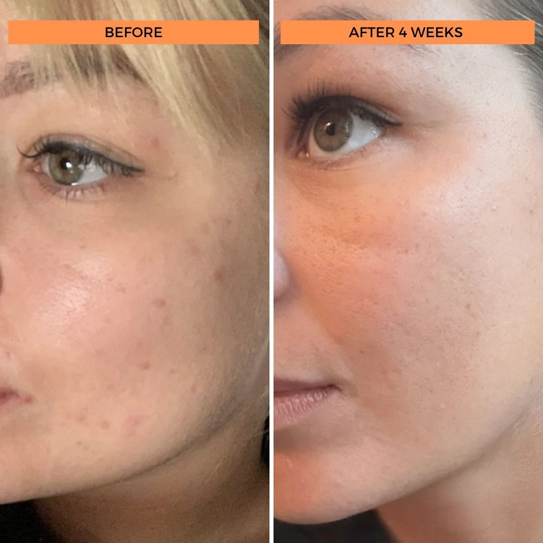 BeautyStat Universal C Skin Refiner 5
