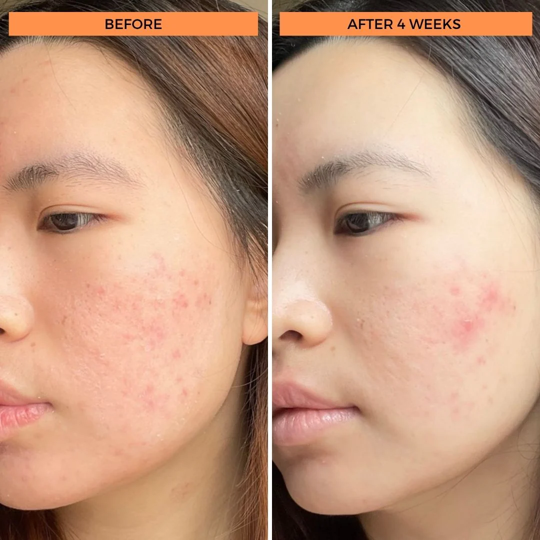 BeautyStat Universal C Skin Refiner 6